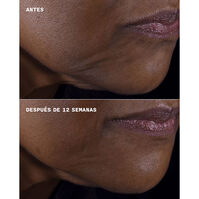 Clinique Smart Clinical Repair Lifting Face + Neck Cream  50ml-214053 4